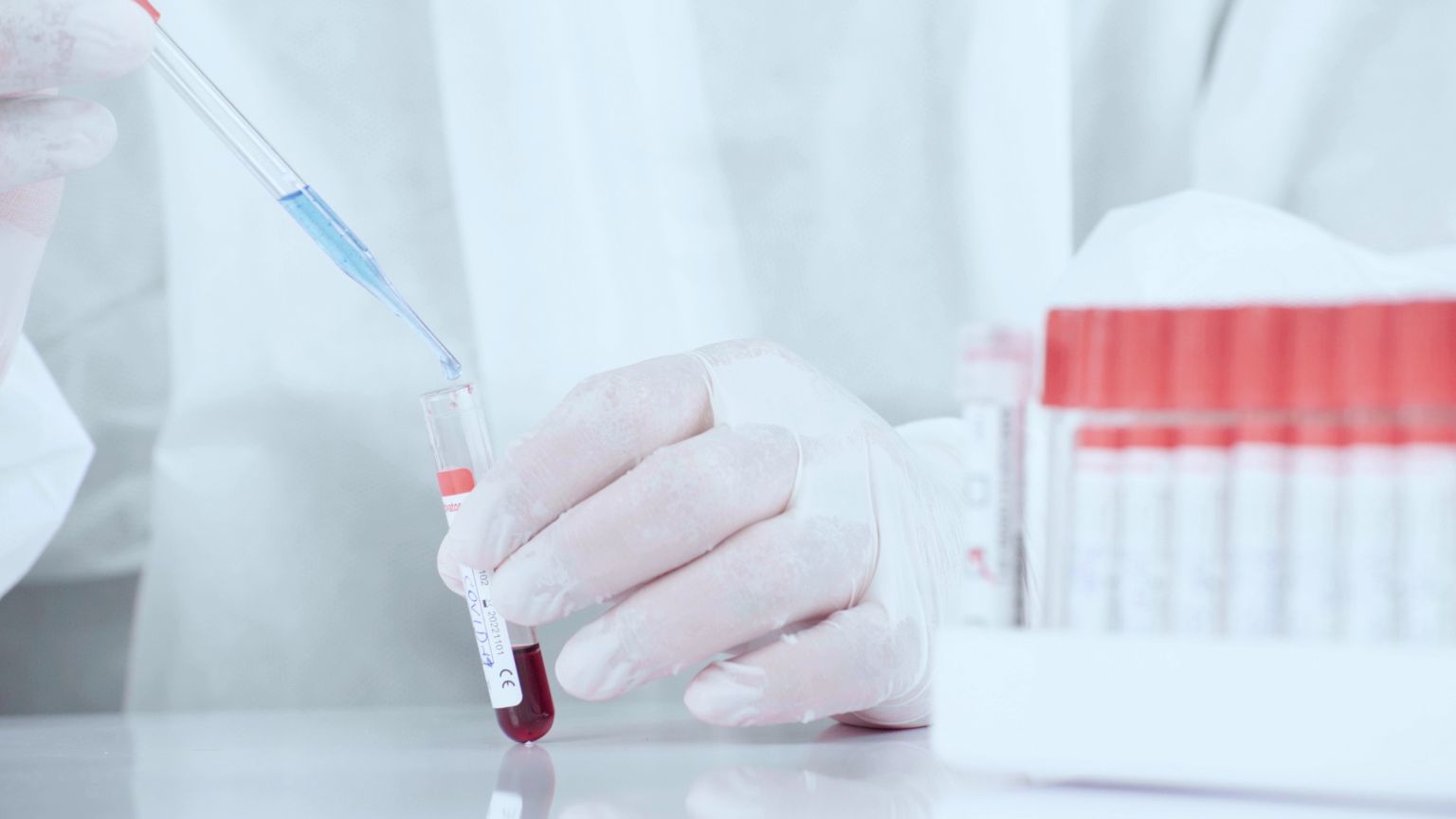 Placeholder